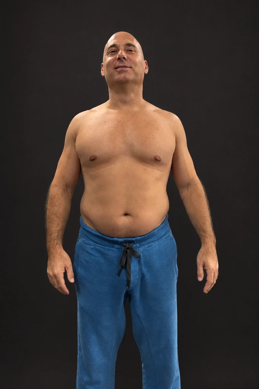 Barry Honig, before-and-after comparison: before