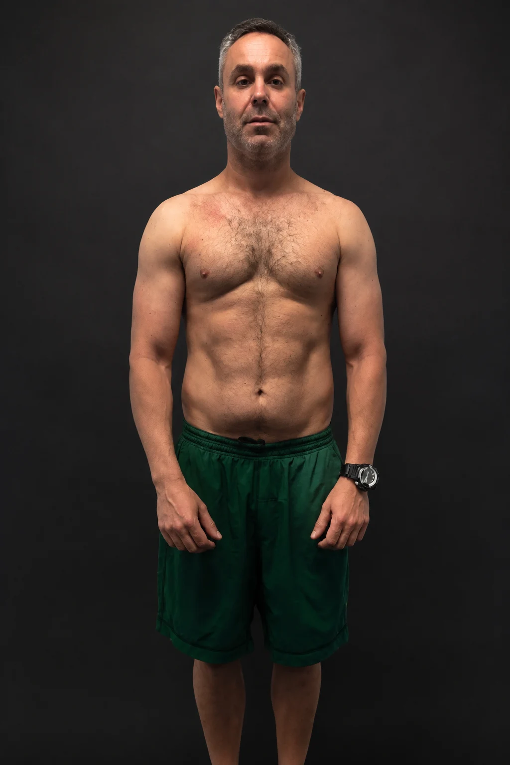 Brad Rose, before-and-after comparison: after