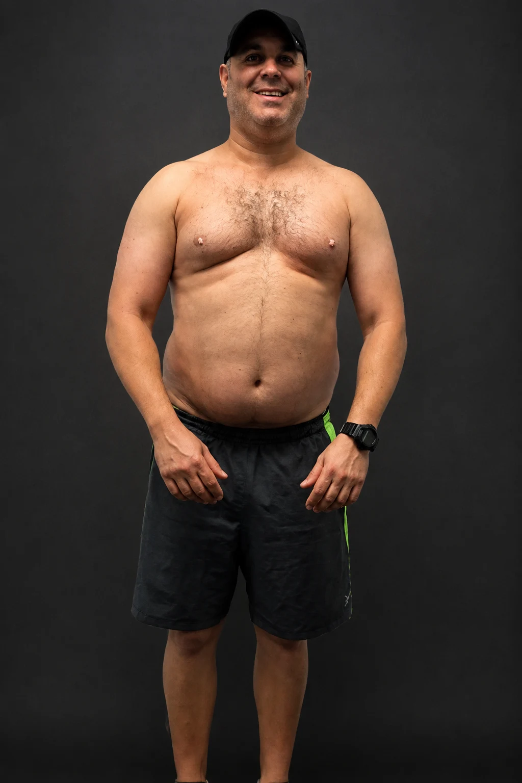 Brad Rose, before-and-after comparison: before