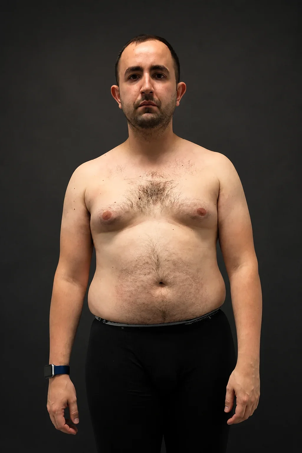 Progress story 31, before-and-after comparison: before