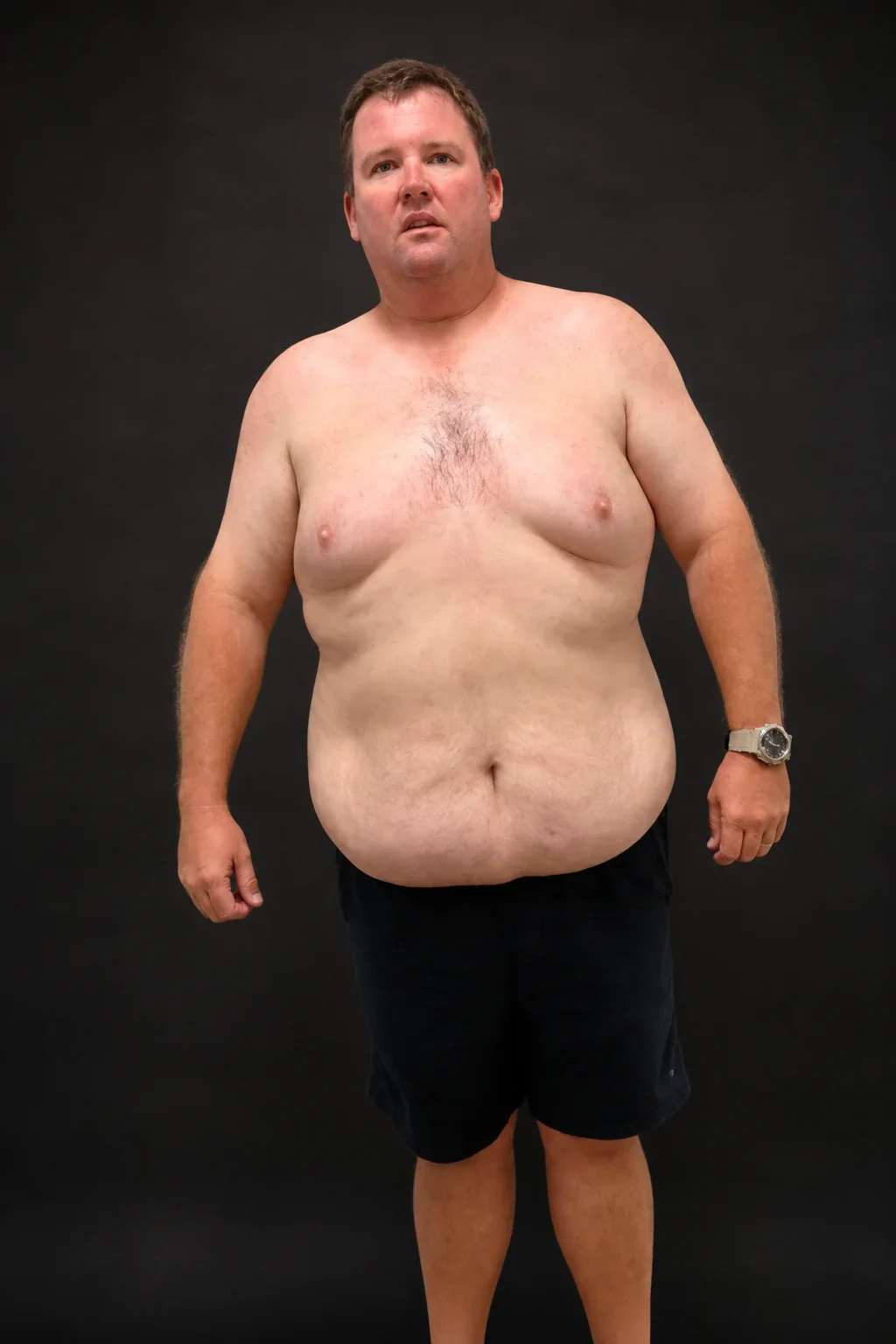 Darrin Dunlea, before-and-after comparison: before