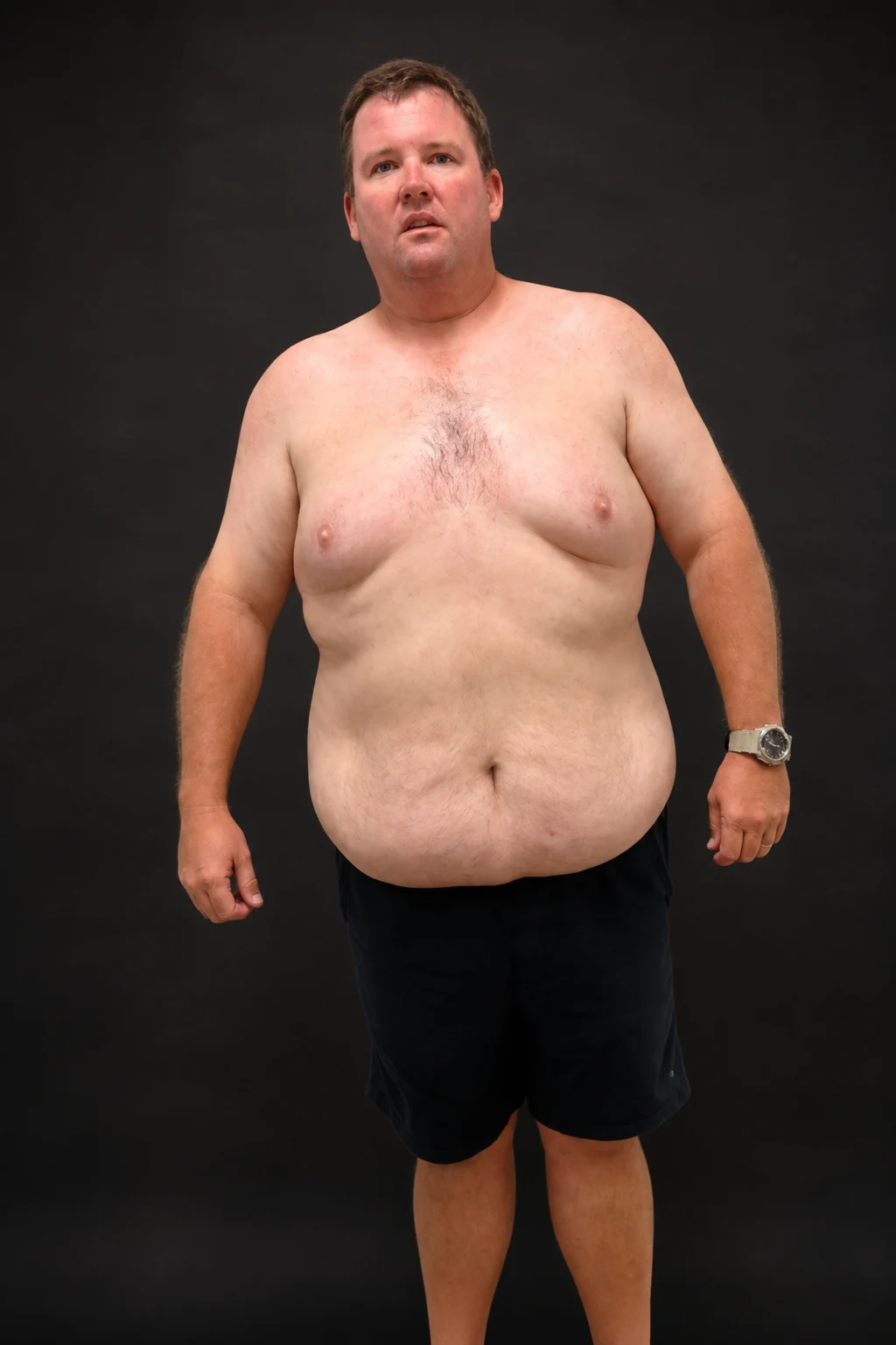 Darrin Dunlea, before-and-after comparison: before