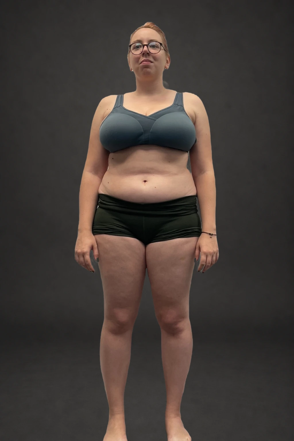 Magda Borgarelli, before-and-after comparison: before