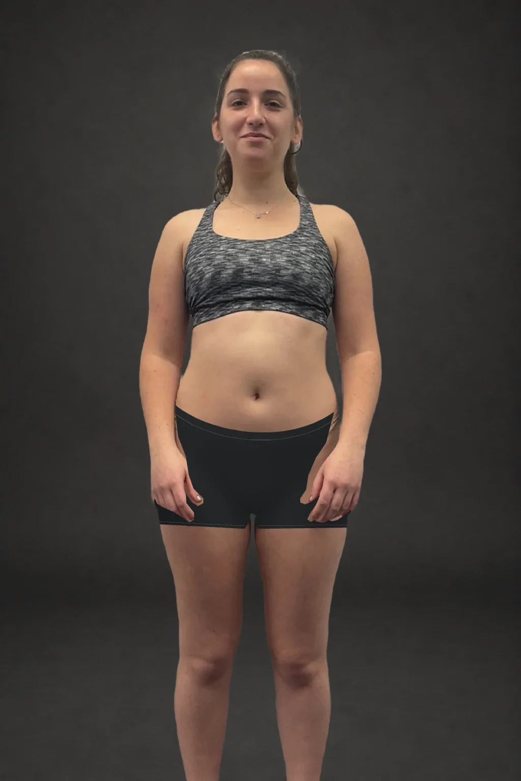 Leah Kleinberg, before-and-after comparison: before