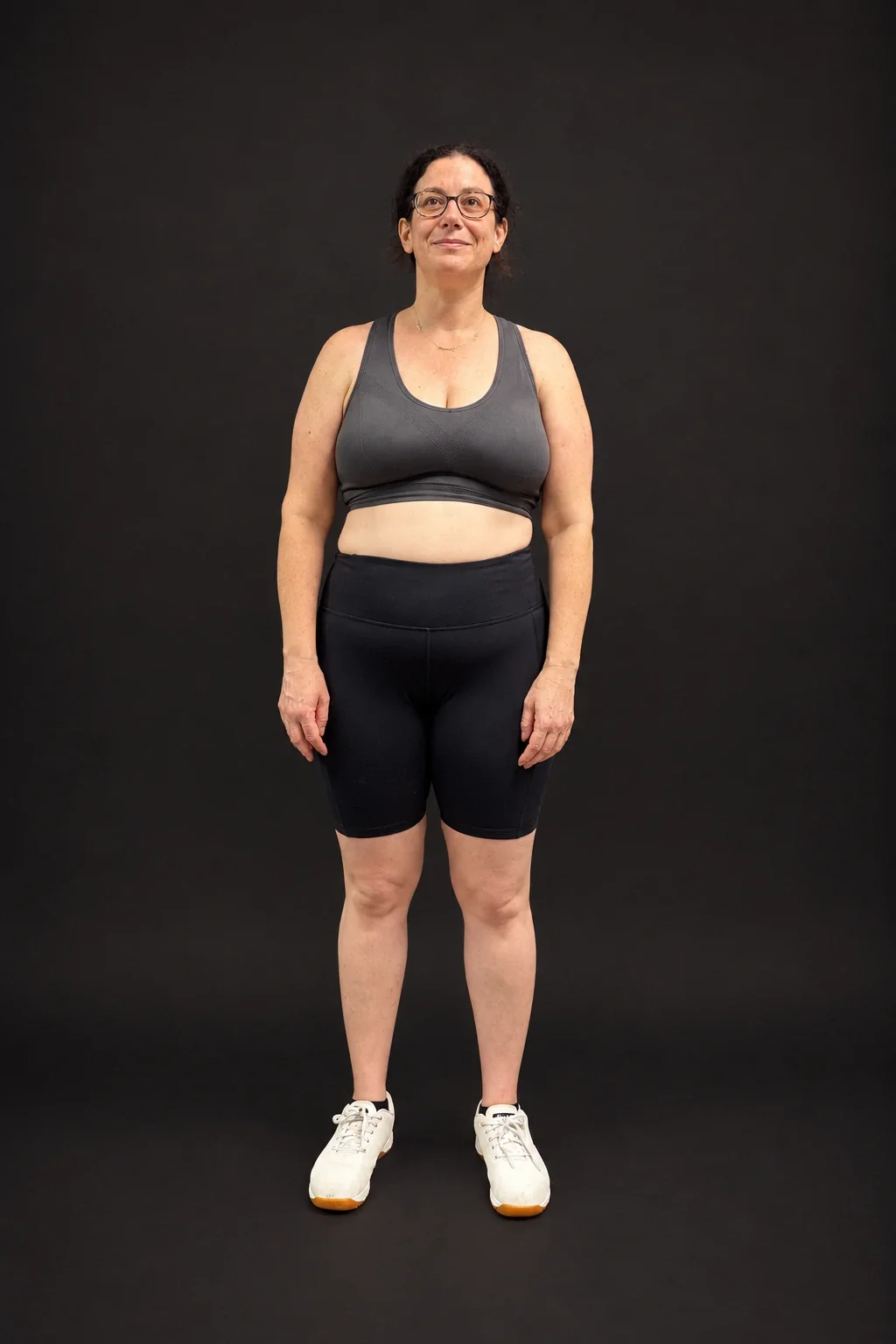 Samantha Moran, before-and-after comparison: after
