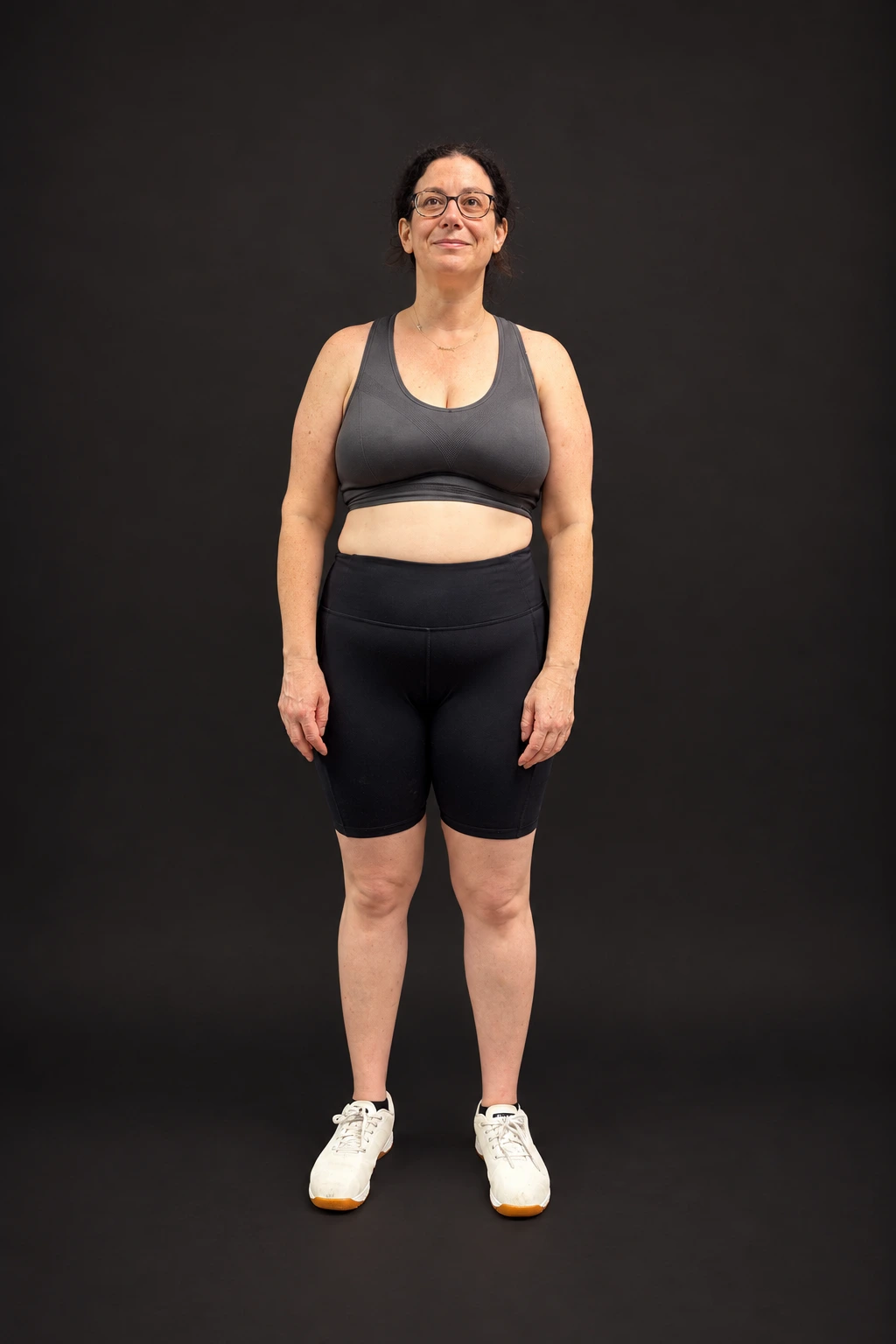 Samantha Moran, before-and-after comparison: after