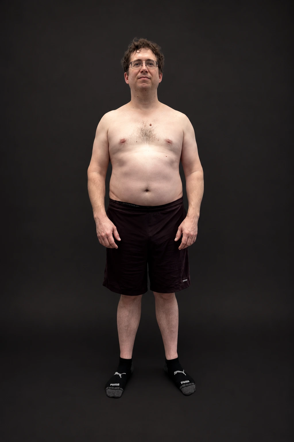 Nicholas Moran, before-and-after comparison: before