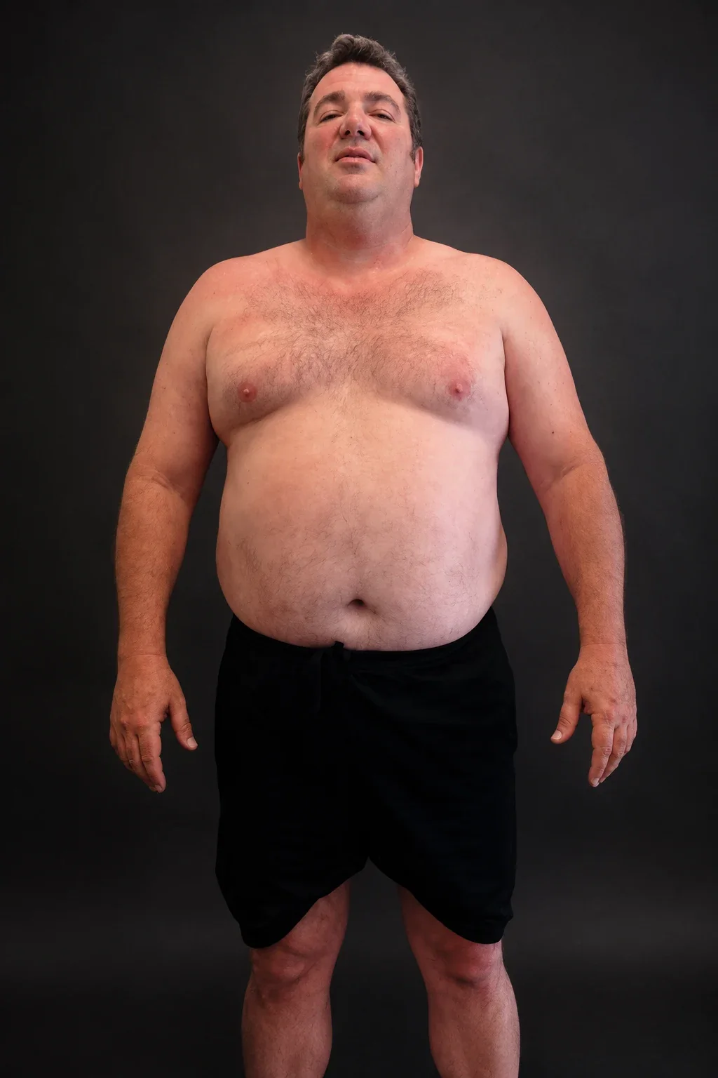 Marc McGinnis, before-and-after comparison: before