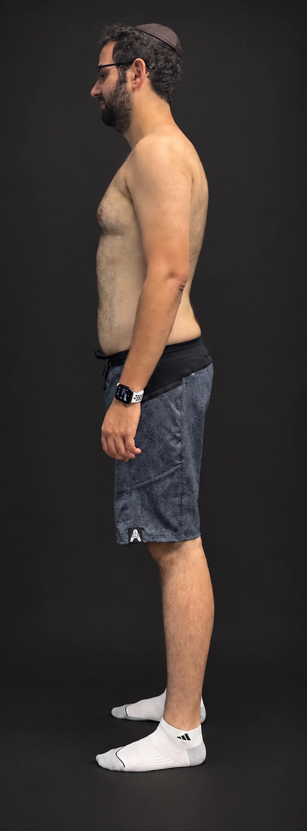 Shlomo H., before-and-after comparison: after